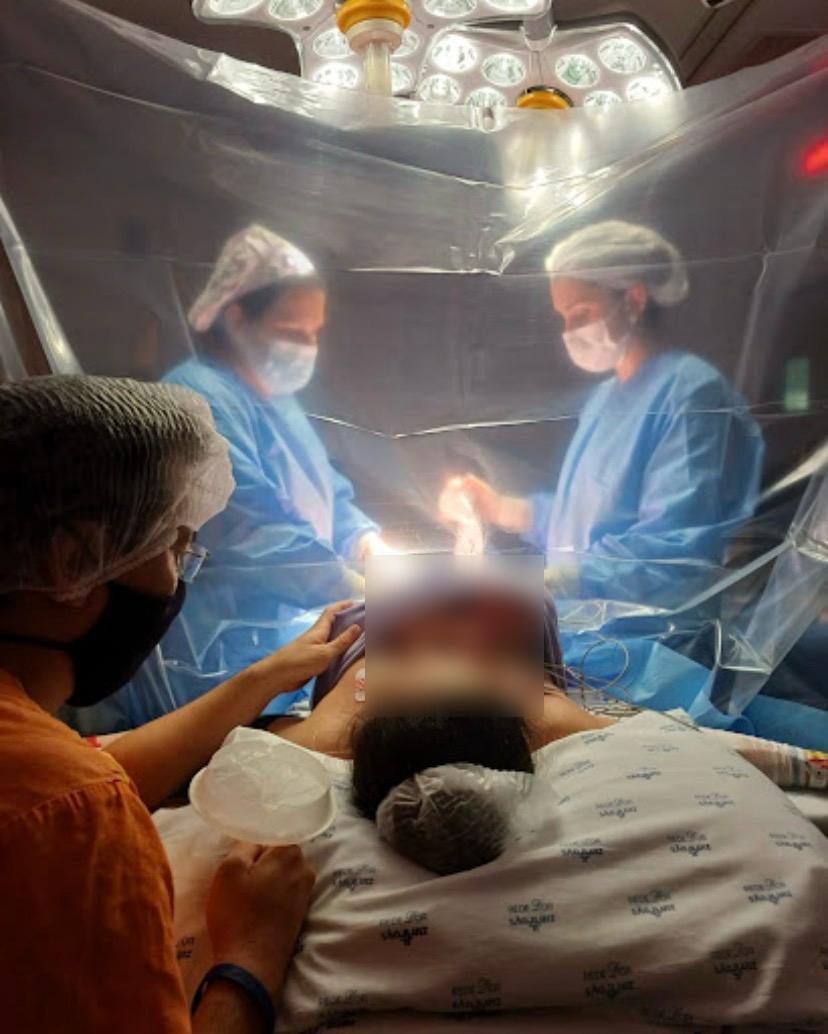 Cesárea humanizada — bebê em skin-to-skin imediatamente após o nascimento